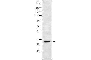 Western blot analysis of MRP-L48 using HuvEc whole cell lysates (MRPL48 anticorps  (Internal Region))