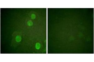 Immunofluorescence analysis of HuvEc cells, using Histone H4 (Phospho-Ser47) Antibody. (Histone H4 anticorps  (pSer47))