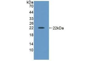 Detection of Recombinant ACVA, Human using Polyclonal Antibody to Activin A (ACVA)