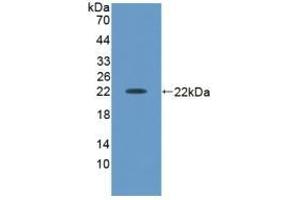 Detection of Recombinant ACVA, Human using Polyclonal Antibody to Activin A (ACVA) (ACVA anticorps  (AA 44-178))