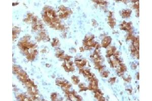 Formalin-fixed, paraffin-embedded rat stomach stained with TNF alpha antibody. (TNF alpha anticorps)