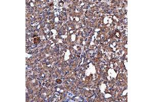 IHC analysis of SCO1 using anti-SCO1 antibody (ABIN7600609). (SCO1 anticorps  (AA 21-301))