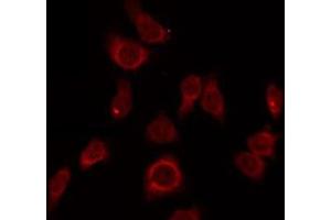 ABIN6275705 staining LOVO by IF/ICC. (ZP1 anticorps  (Internal Region))