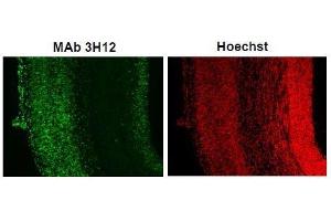 Immunofluorescence (IF) image for anti-Small Ubiquitin Related Modifier 2/3 (SUMO2/3) (full length) antibody (ABIN2452139) (SUMO2/3 anticorps  (full length))