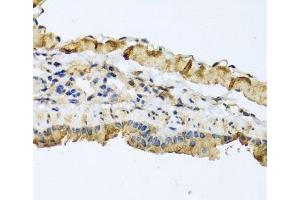 Immunohistochemistry of paraffin-embedded Mouse lung using ATP2C1 Polyclonal Antibody at dilution of 1:100 (40x lens). (ATP2C1 anticorps)