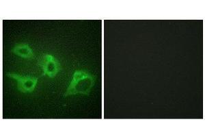 Immunofluorescence (IF) image for anti-Casein Kinase 1, alpha 1 (CSNK1A1) (Internal Region) antibody (ABIN6299683) (CSNK1A1 anticorps  (Internal Region))