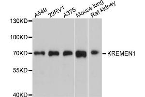 Western blot analysis of extracts of various cell lines, using KREMEN1 antibody (ABIN5998094) at 1/1000 dilution. (KREMEN1 anticorps)