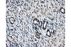 Immunohistochemical staining of paraffin-embedded liver tissue using anti-LOXmouse monoclonal antibody. (LOX anticorps  (AA 22-168))