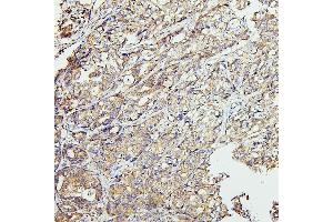 IHC analysis of CETP using anti-CETP antibody (ABIN7602439).