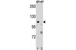 PARP1 antibody pre-incubated without (lane 1) and with (2) blocking peptide in NCI-H292 lysate