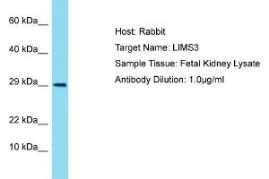 Host: Rabbit Target Name: LIMS4 Sample Tissue: Human Fetal Kidney Antibody Dilution: 1ug/ml (LIMS3 anticorps  (N-Term))