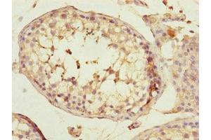 Immunohistochemistry of paraffin-embedded human testis tissue using ABIN7170585 at dilution of 1:100
