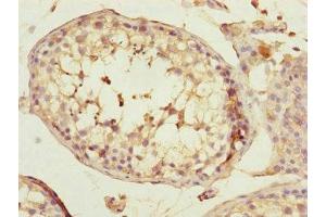 Immunohistochemistry of paraffin-embedded human testis tissue using ABIN7170585 at dilution of 1:100 (SPICE1 anticorps  (AA 1-220))