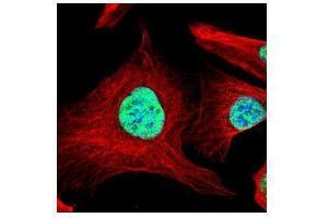 ICC/IF Image Confocal immunofluorescence analysis (Olympus FV10i) of paraformaldehyde-fixed U2OS, using SART1, antibody (Green) at 1:500 dilution. (SART1 anticorps  (Internal Region))