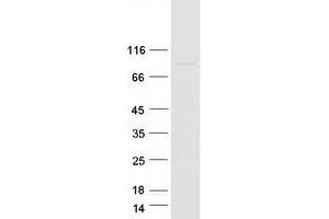Validation with Western Blot