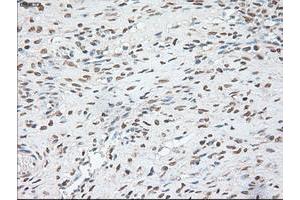 Immunohistochemistry (IHC) image for anti-POU Class 5 Homeobox 1 (POU5F1) antibody (ABIN1500354) (OCT4 anticorps)