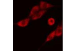 ABIN6274279 staining COLO205 cells by IF/ICC. (NCBP2 anticorps  (N-Term))