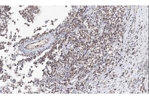 anti-Arginine Decarboxylase (ADC) (AA 111-301) antibody