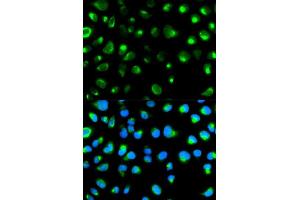 Immunofluorescence analysis of MCF7 cell using GYPC antibody. (CD236/GYPC anticorps  (AA 1-128))