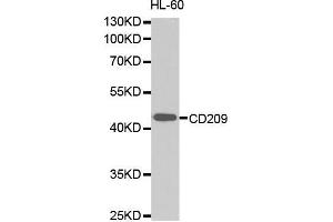 Western Blotting (WB) image for anti-CD209 (CD209) (AA 265-404) antibody (ABIN1679076) (DC-SIGN/CD209 anticorps  (AA 265-404))