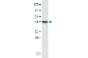 Western Blot detection against Immunogen (45.