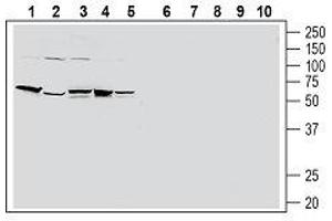Western blot analysis of human HT-29 colon adenocarcinoma cell line lysate (lanes 1 and 6), human PANC-1 pancreatic carcinoma cell line lysate (lanes 2 and 7), human THP-1 monocytic leukemia cell line lysate (lanes 3 and 8), human Jurkat T-cell leukemia cell line lysate (lanes 4 and 9) and human MCF-7 breast adenocarcinoma cell line lysate (lanes 5 and 10): - 1-5. (F2RL1 anticorps  (Extracellular, N-Term))