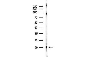 Western blot analysis of lysates from K562 cells(UV 30 min treatment), using MLC2 Antibody at 1/1000 dilution.