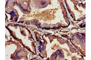 Immunohistochemistry of paraffin-embedded human prostate tissue using ABIN7172109 at dilution of 1:100 (Thymic Stromal Lymphopoietin anticorps  (AA 29-159))