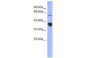 RAD23B antibody used at 1 ug/ml to detect target protein. (RAD23B anticorps)
