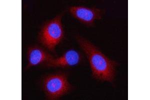 IF analysis of GSDMD using anti-GSDMD antibody (ABIN7599431). (GSDMD anticorps  (AA 1-484))