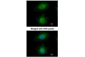 ICC/IF Image Immunofluorescence analysis of paraformaldehyde-fixed HeLa, using MVD, antibody at 1:200 dilution. (MVD anticorps  (Center))