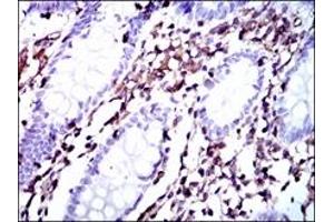 Immunohistochemistry (IHC) image for anti-Moesin (MSN) antibody (ABIN1108275)