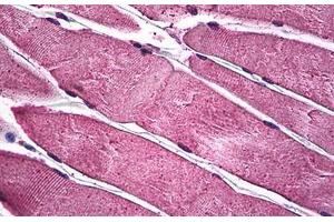 Human Skeletal Muscle: Formalin-Fixed, Paraffin-Embedded (FFPE)