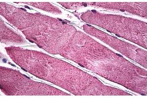 Human Skeletal Muscle: Formalin-Fixed, Paraffin-Embedded (FFPE) (PIM1 anticorps  (AA 1-314))
