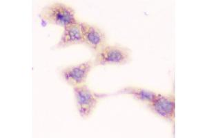 IHC analysis of SMN1/2 using anti-SMN1/2 antibody (ABIN5693315).