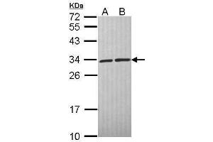 WB Image Sample (30 ug of whole cell lysate) A: A431 , B: H1299 12% SDS PAGE antibody diluted at 1:1000