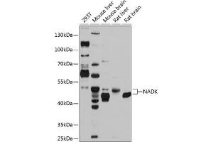 Western blot analysis of extracts of various cell lines, using NADK antibody (ABIN6128326, ABIN6144340, ABIN6144341 and ABIN6224894) at 1:1000 dilution. (NADK anticorps  (AA 1-180))