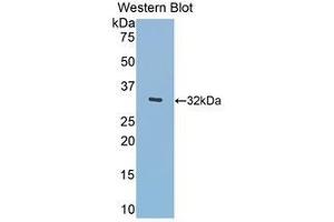 Western Blotting (WB) image for anti-Meningioma Expressed Antigen 5 (Hyaluronidase) (MGEA5) (AA 319-450) antibody (ABIN1859957) (MGEA5 anticorps  (AA 319-450))