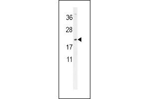 DMRTC1 Antibody (N-term) (ABIN654523 and ABIN2844245) western blot analysis in MDA-M cell line lysates (35 μg/lane). (DMRTC1 anticorps  (N-Term))