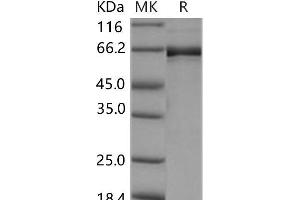 Western Blotting (WB) image for EPH Receptor B2 (EPHB2) (AA 570-987) (Active) protein (GST tag,His tag) (ABIN7317086)