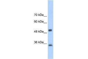 WB Suggested Anti-AIP Antibody Titration:  2. (AIP anticorps  (N-Term))