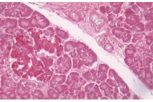Human Pancreas: Formalin-Fixed, Paraffin-Embedded (FFPE) (LPAR6 anticorps  (C-Term))