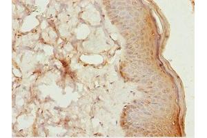 Immunohistochemistry of paraffin-embedded human skin tissue using ABIN7158391 at dilution of 1:100 (LHX6 anticorps  (AA 114-363))