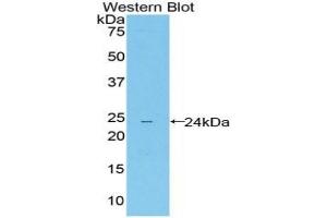 Detection of Recombinant LILRB4, Mouse using Polyclonal Antibody to Leukocyte Immunoglobulin Like Receptor Subfamily B, Member 4 (LILRB4)