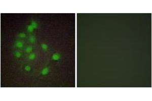 Immunofluorescence analysis of A549 cells, using HAND1 Antibody. (HAND1 anticorps  (AA 141-190))