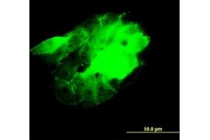 Image no. 4 for anti-CDC42 Binding Protein Kinase beta (DMPK-Like) (CDC42BPB) (AA 1580-1679) antibody (ABIN599085) (CDC42BPB anticorps  (AA 1580-1679))