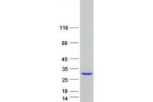 Validation with Western Blot