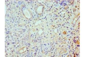 Immunohistochemistry of paraffin-embedded human kidney tissue using ABIN7168003 at dilution of 1:100 (ROCK2 anticorps  (AA 1109-1388))