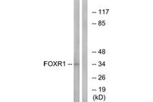 Western Blotting (WB) image for anti-Forkhead Box R1 (FOXR1) (AA 231-280) antibody (ABIN2890325) (FOXR1 anticorps  (AA 231-280))