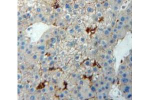 Used in DAB staining on fromalin fixed paraffin-embedded Liver tissue (TJP1 anticorps  (AA 1-190))